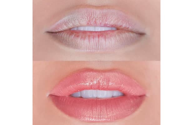 Realza Centro de Estética (Av. JK): 1, 3 ou 5 Sessões de Nutri Gloss Lips, a partir de R$125. Deixe Seus Lábios Profundamente Hidratados!